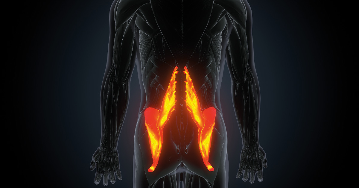 Illustration of a body with the Psoas Muscle highlighted in orange